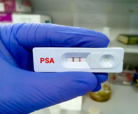 psa sois|PSA.